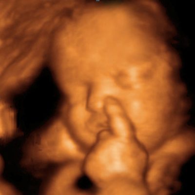 3d ultrasound brampton ontario