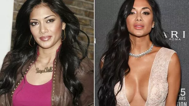 nicole scherzinger breast implants