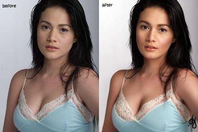 bea alonzo before after