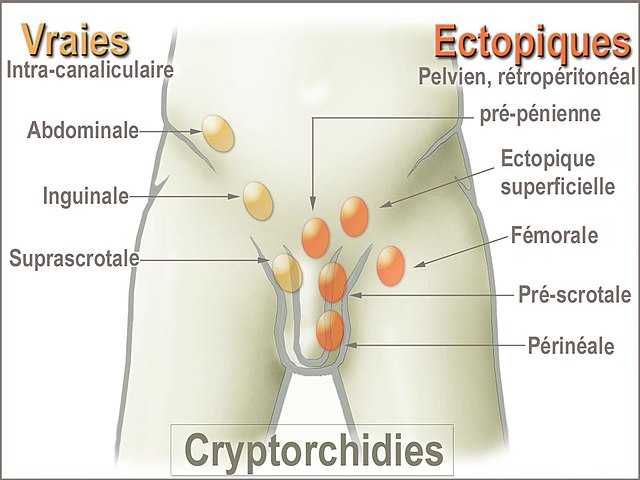 micropenis wiki