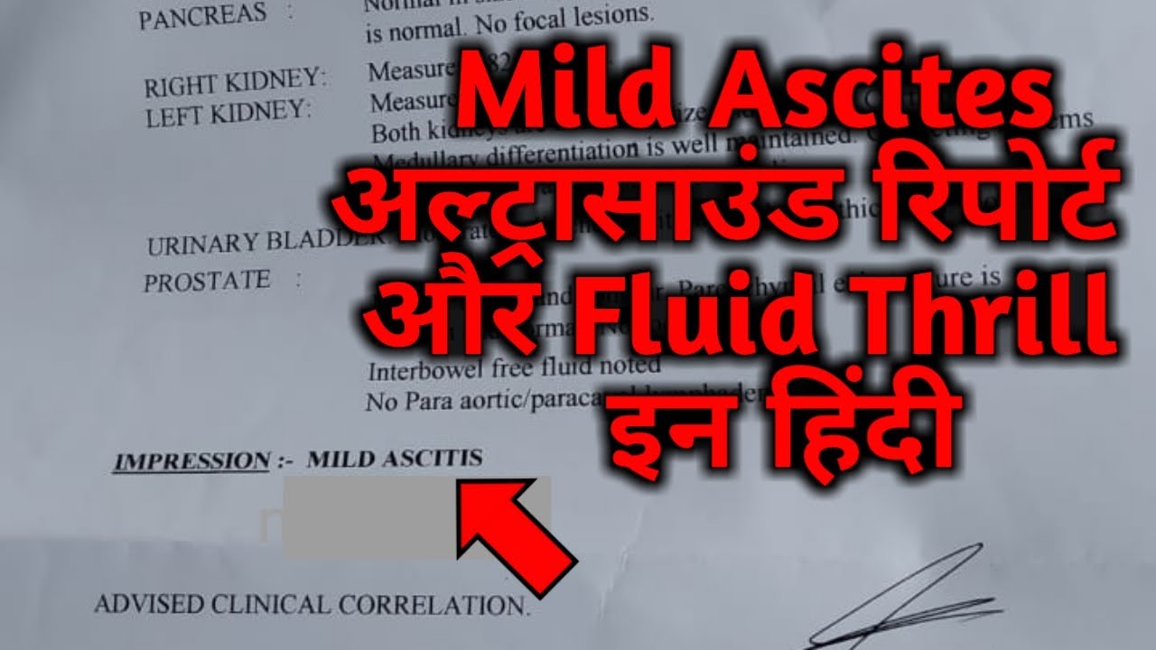 mild to moderate ascites in hindi