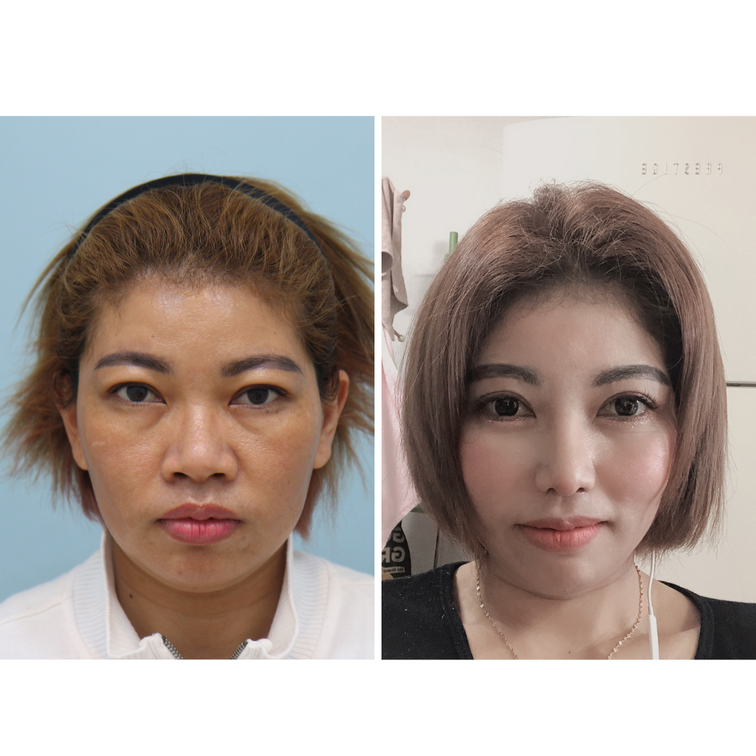 jewelry plastic surgery korea review