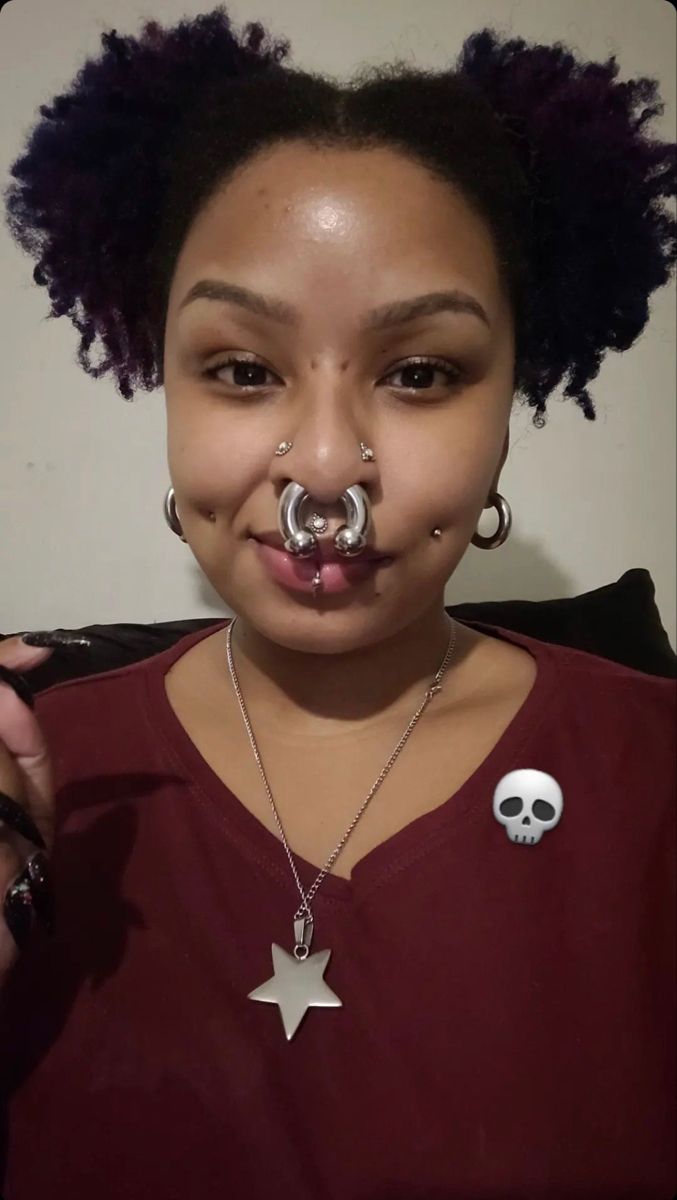 stretched septum