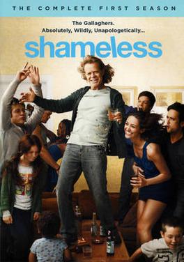 shameless series