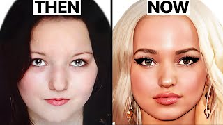 dove cameron plastic surgery