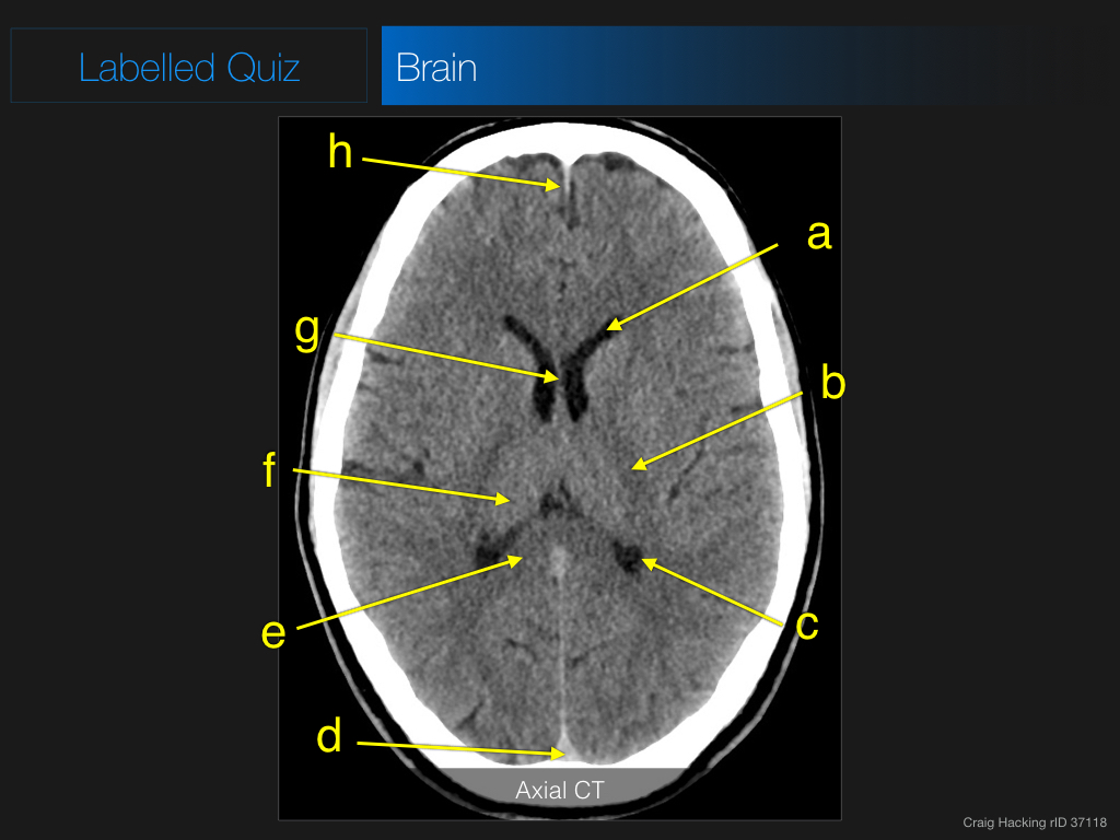 radiopaedia quiz