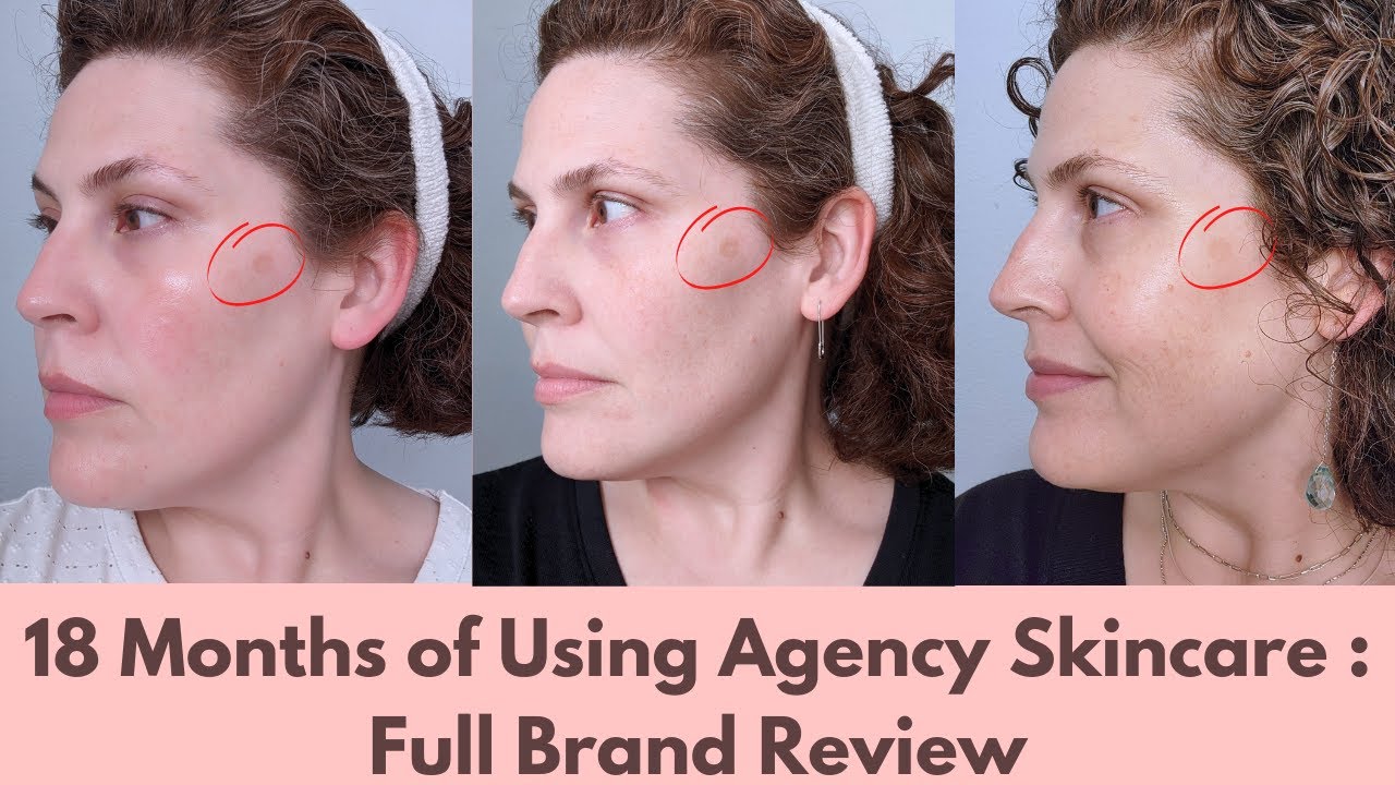 reviews on agency skincare