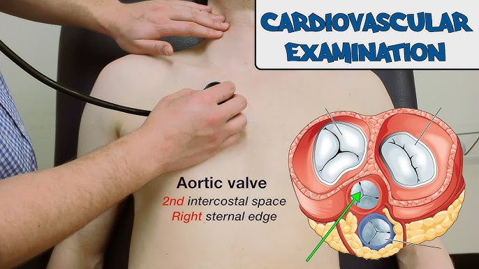 cardiovascular examination geeky medics