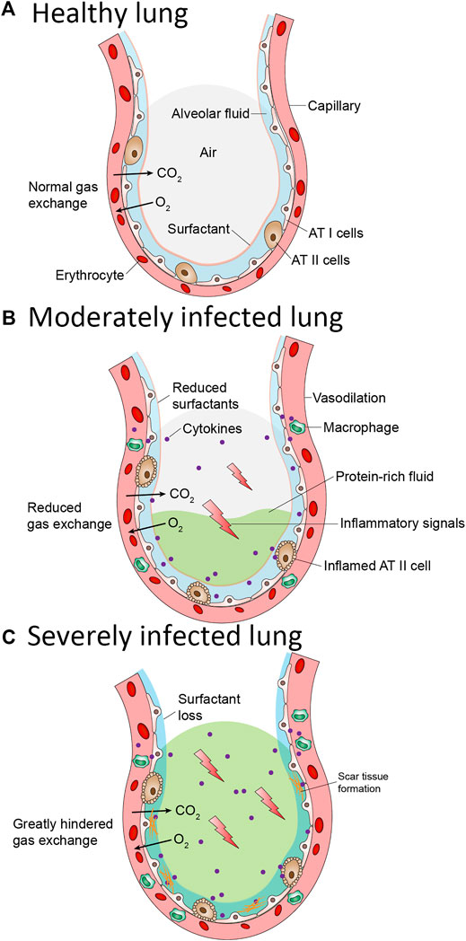 what is pulmonary surfactant