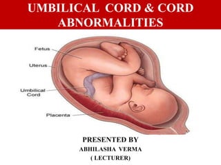 umbilical cord abnormalities ppt