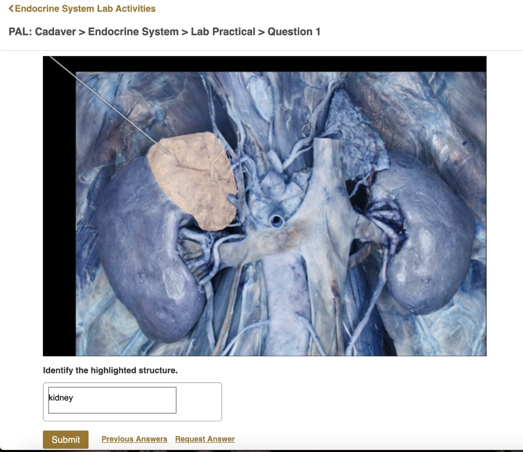 identify the highlighted structure endocrine system