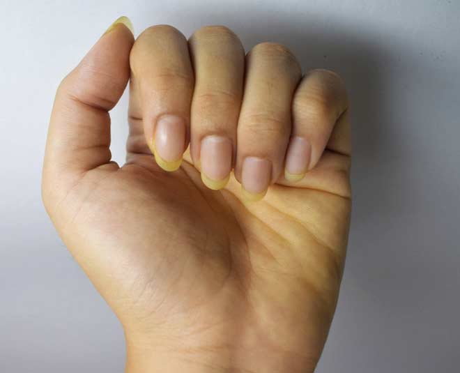 how to remove turmeric stains from nails