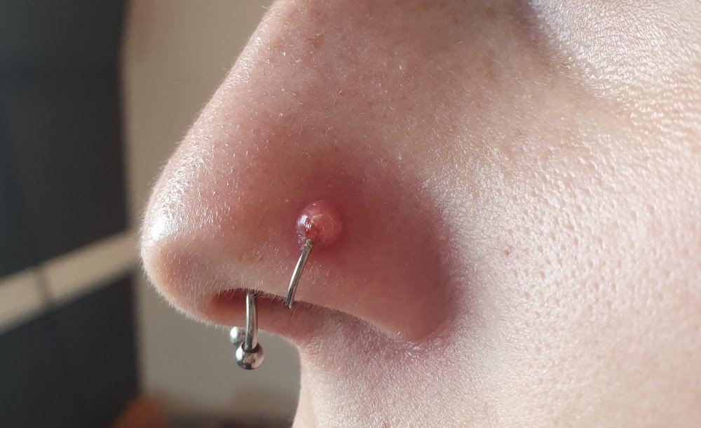bump inside nose from piercing