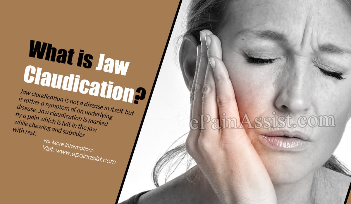 define jaw claudication