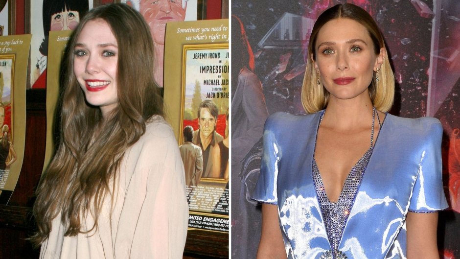 elizabeth olsen plastic surgery