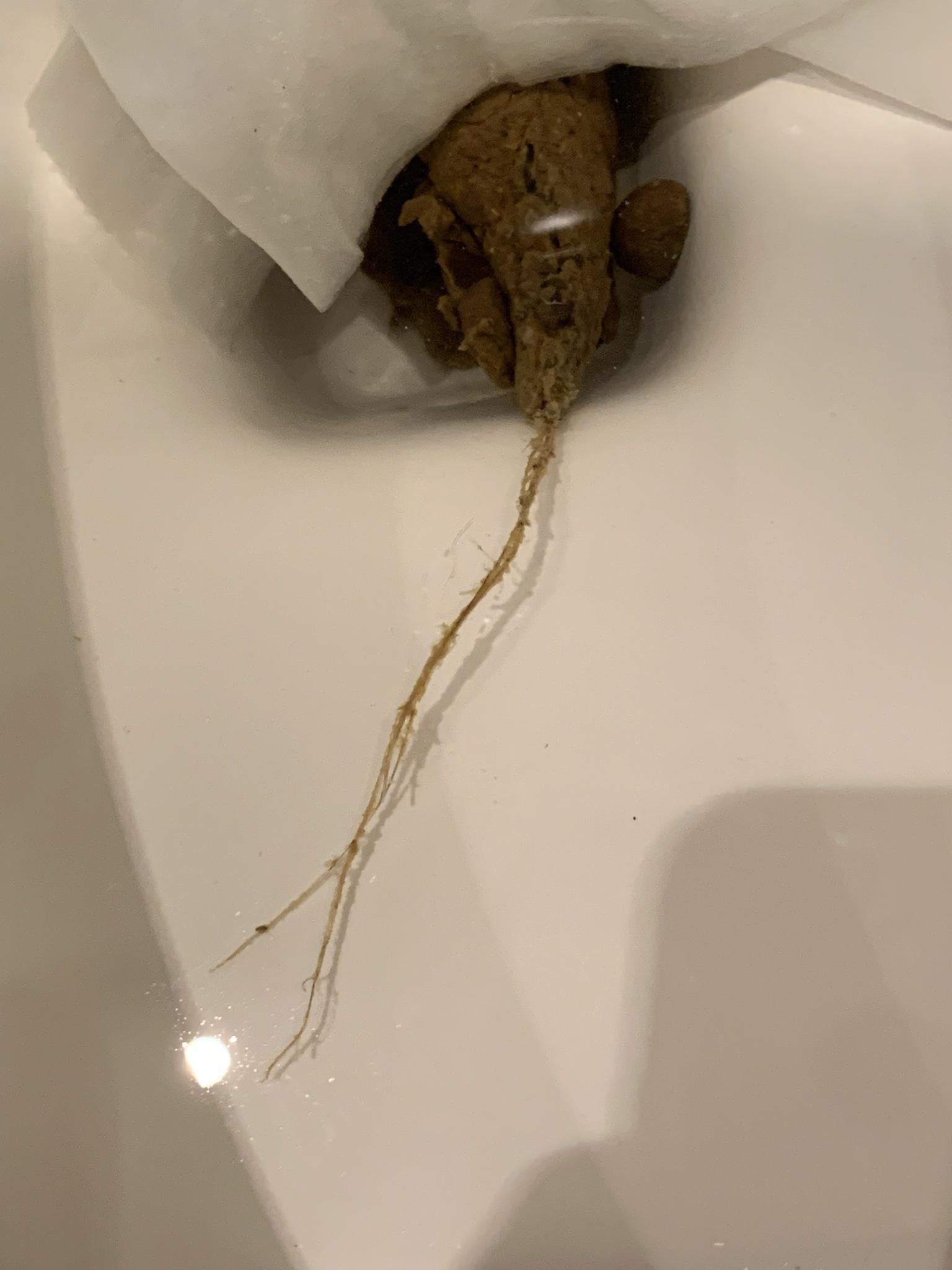 fiber strings in poop pictures