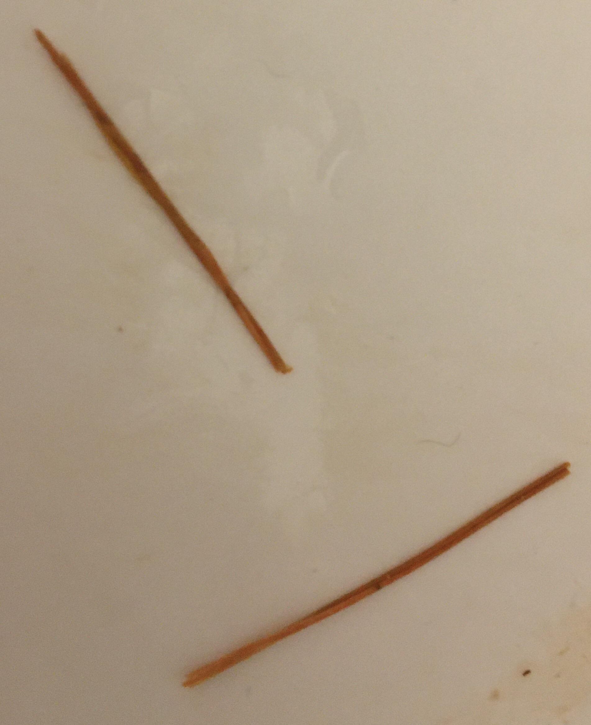 fiber strings in poop