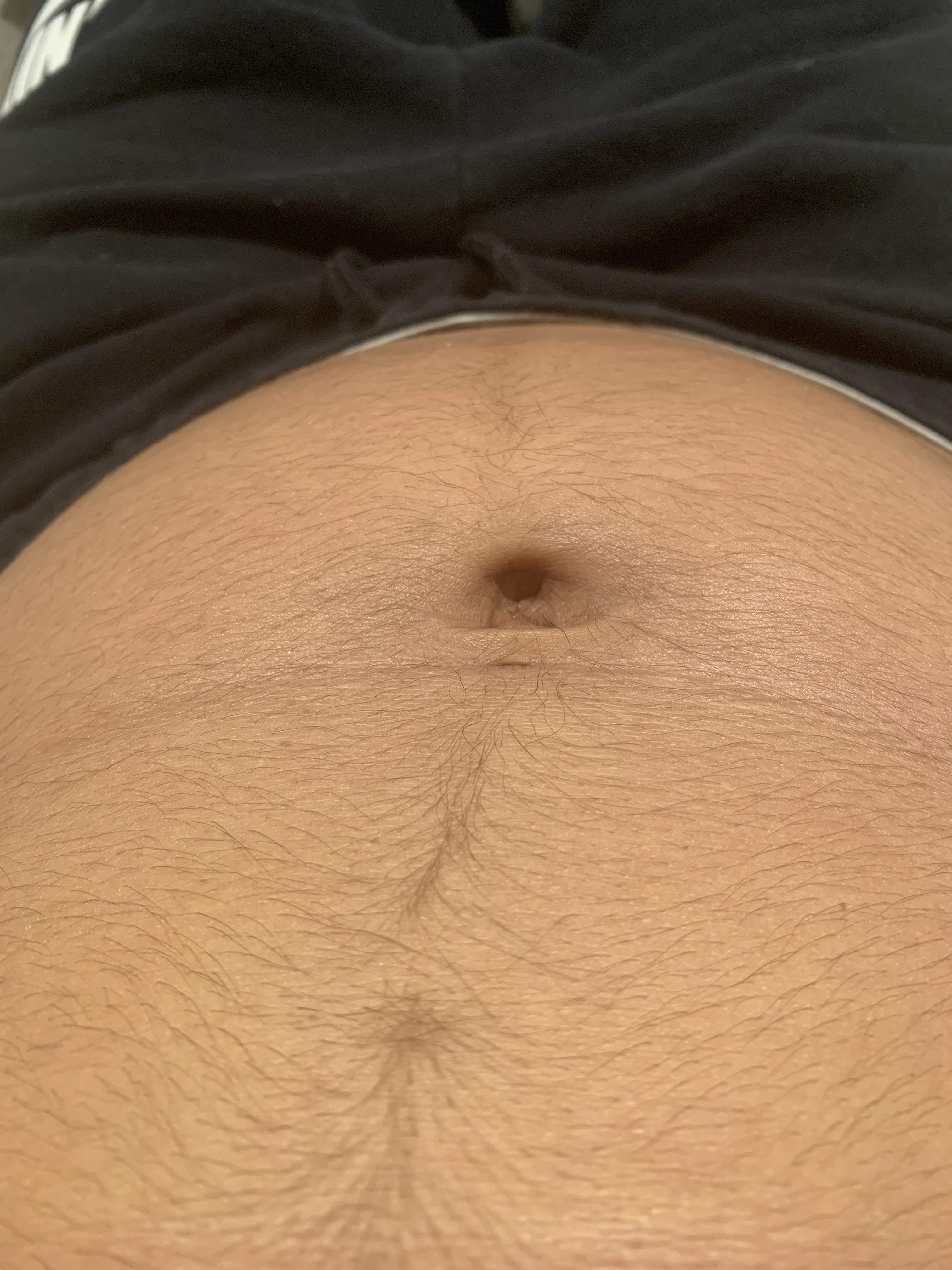 hairy stomach when pregnant