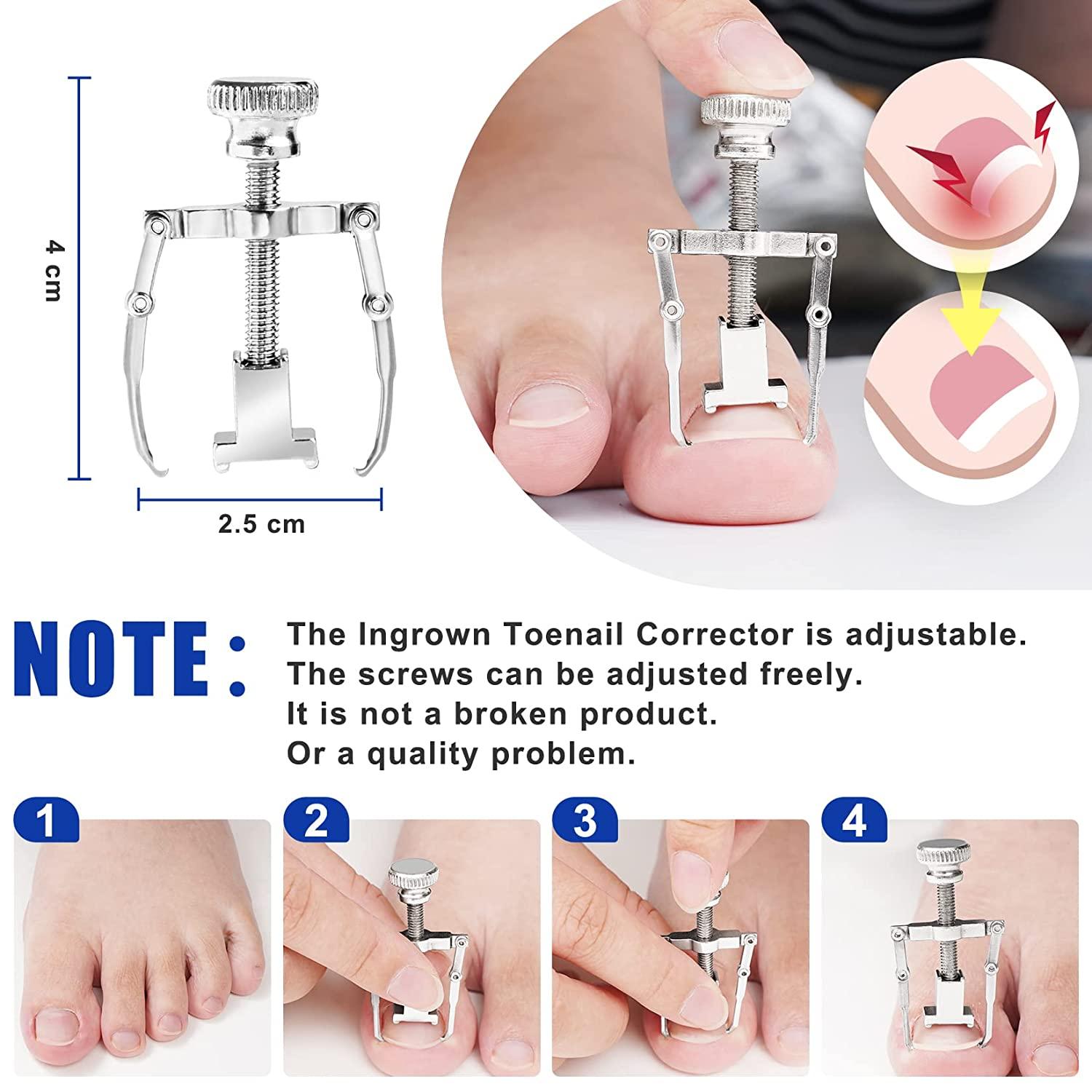 ingrown toenail tool