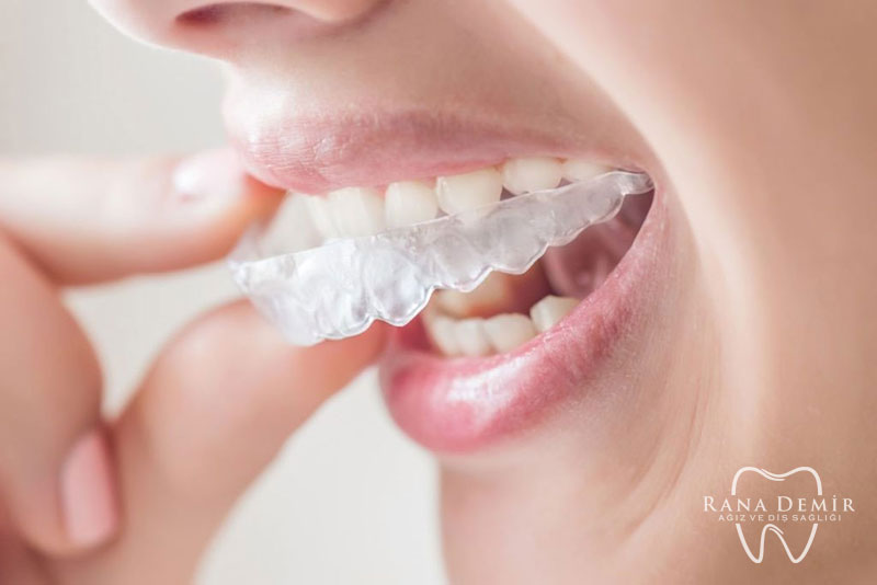 invisalign konya