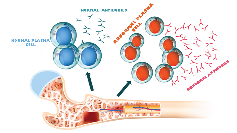 miracle cure for cll