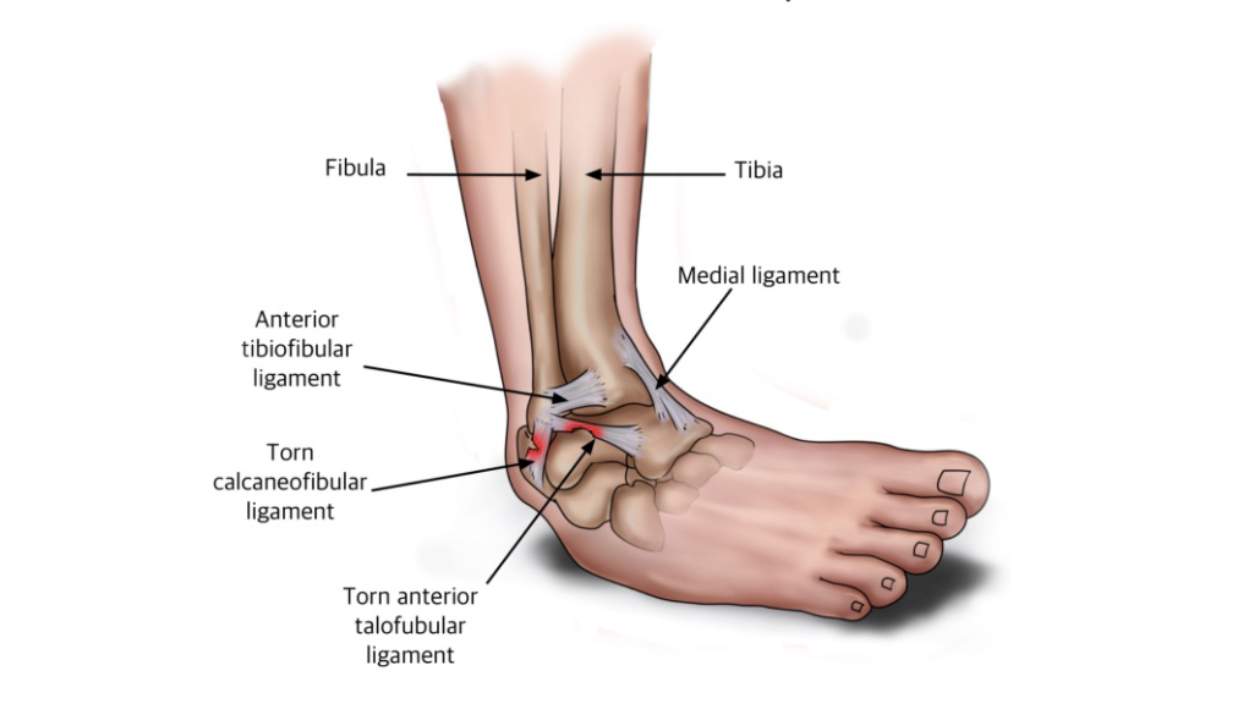 pain in right foot icd 10